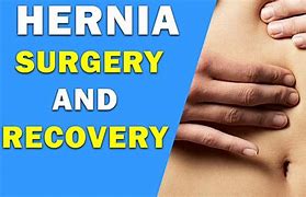 Image result for Hernia Surgery Choses