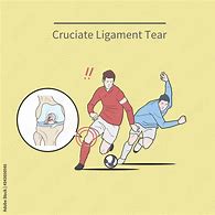 Image result for ACL Injury Cartoon