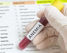 Image result for acaeemia