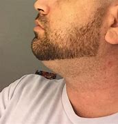 Image result for Double Chin Beard