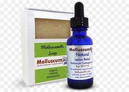 Image result for Molluscum Contagiosum Soap