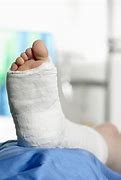 Image result for Broken Foot Pain