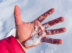 Image result for hypothermia