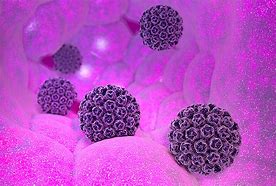 Image result for HPV Cauliflower Wart
