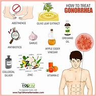 Image result for Pharyngeal Gonorrhea