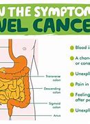 Image result for Bowel Cancer Women