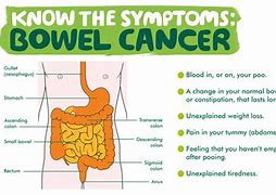 Image result for Bowel Cancer Pain Symptoms