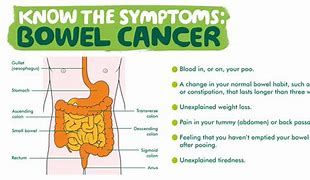 Image result for Bowel Cancer Women