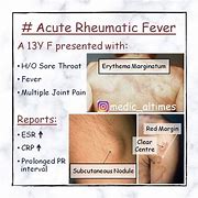 Image result for rheumatic