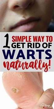 Image result for How to Get Rid of Skin Warts