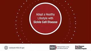 Image result for Sickle Cell Symptoms