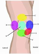 Image result for Sharp Knee Pain