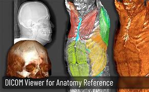 Image result for DICOM 3D Viewer