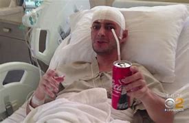 Image result for Head Surgery Recovery Patient
