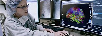 Image result for Brain Surgery Map