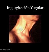 Image result for ingurgitaci�n