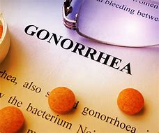 Image result for Gonorrhoea