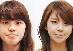 Image result for South Korea Plastic Surgery