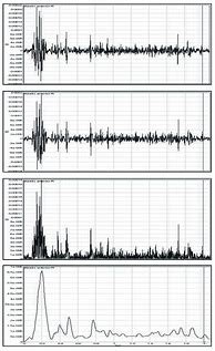 Image result for EMG Signal Processing
