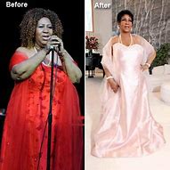 Image result for Dramatic Weight Loss Before and After