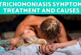 Image result for Trichomoniasis