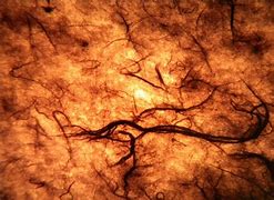 Image result for Gross Texture Skin