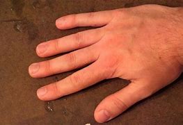 Image result for Normal Hand
