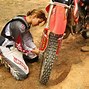 Image result for Suzuki Motorcycle Teenager Broken Foot