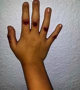 Image result for Bloody Knuckles Pictures