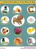 Image result for Home Remedies for Warts