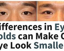 Image result for Make Eyelids Look Smaller