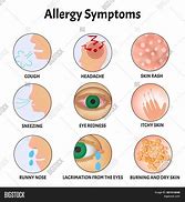 Image result for Allergy Signs and Symptoms