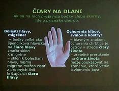 Image result for Ciara Lasky Zivota Na Ruke