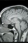 Image result for Human Brain Shrinking