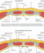 Image result for Cesarean Section Anatomy