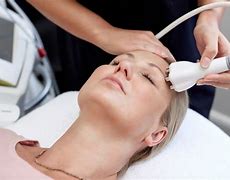 Image result for Radiofrequency Treatment