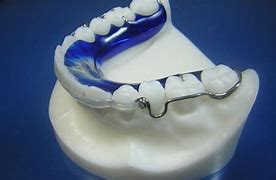 Image result for C Clasp Ortho