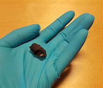 Image result for 9000 Year Old Chewing Gum