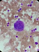 Image result for Megakaryocytes