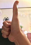Image result for World's Biggest Thumb