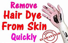 Image result for How to Get Hair Dye Off Skin