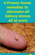 Image result for 6Mm Kidney Stone Actual Size