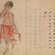Image result for Japanese Smallpox Sources