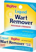 Image result for Liquid Nitrogen Wart Removal
