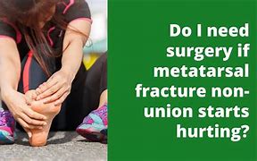 Image result for Left 5th Metatarsal Fracture