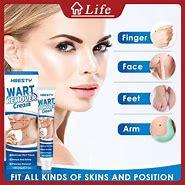 Image result for Filiform Wart Removal