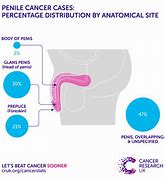 Image result for penile cancer