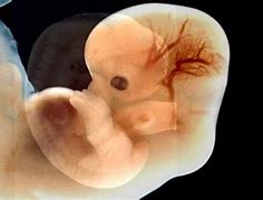 Image result for What Does a Baby Look Like at 4 Weeks