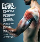 Image result for Muscle Torn Marks