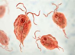 Trichomoniasis 的图像结果